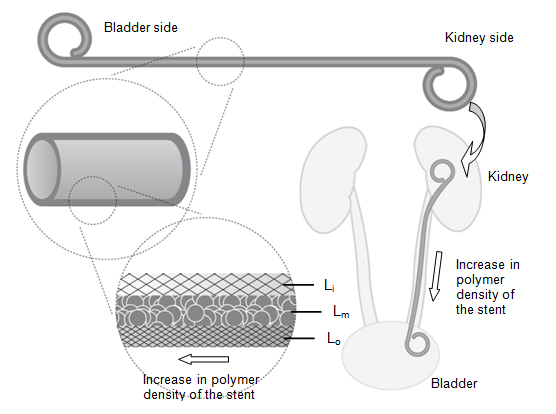 Schematic representation of a biodegradable ureteral stent